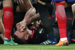 Piala Dunia 2018: Bek Prancis Laurent Koscielny Absen karena Cedera