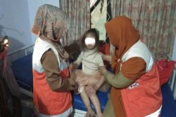 Kesehatan Balita Us Menurun setelah Disekap Ibu Angkat Bersama 6 Anjing