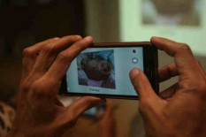 Bayi Kembar Siam, Operasi Pemisahan Belum Bisa Dilakukan
