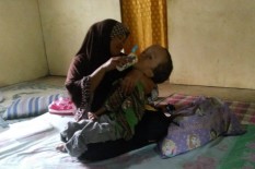 Menderita Hidrosefalus, Bocah 15 Tahun Hanya Memiliki Berat Badan 16 Kg