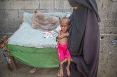 Ratusan Anak Balita di Gunungkidul Menderita Gizi Buruk 