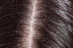 Ini Tips Mengatasi Permasalahan Rambut Orang Indonesia