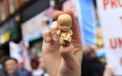 HARI KARTINI: Ironi Aborsi di Antara Praktik Ilegal  Berbahaya