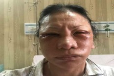 Jadi Saksi, Tompi Sempat Tawarkan Pertolongan untuk Ratna Sarumpaet