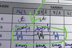 Viral, Simbol Denyut Jantung Jadi Tanda Tangan