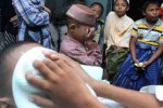 Sunat Bisa Kurangi Risiko Infeksi Virus HIV, HSV, dan HPV