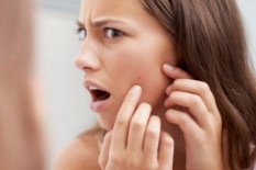 Pakai Antibiotik Berkepanjangan Ternyata Tak Mampu Sembuhkan Jerawat