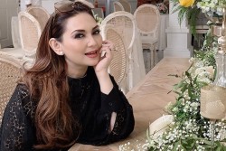 Wajah Nia Daniaty Terhantam Besi saat Kecelakaan di Bojonegoro