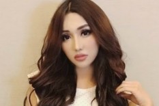 Lucinta Luna Dikabarkan Mengalami Kecelakaan, Seperti Inikah Kondisinya?