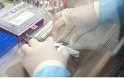 Di Singapura, Tes Virus Corona Covid-19 Cukup 3 Jam