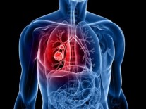 Benarkah Menghirup Uap Air Panas Bisa Cegah Virus Corona? Ini Faktanya