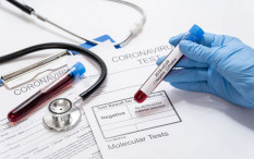 35 Orang di Gunungkidul Positif Covid-19, Terbanyak dari Klaster Gadungsari