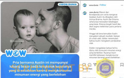 CEK FAKTA: Benarkah Kepala Pria Berlubang Besar jika Konsumsi Minuman Energi secara Berlebihan?