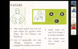 FKIK UMY Adakan Seminar tentang Deteksi Dini Kanker Payudara