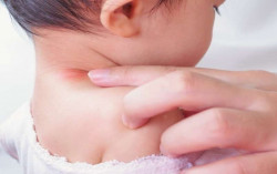 Jangan Anggap Sepele! Kenali Gejala Covid-19 pada Anak!