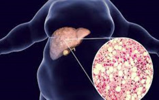 Waspadai! Gejala Sakit Liver Bisa Dilihat dari Kulit 