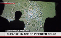 Begini Gambar Sel yang Terinfeksi Virus Corona