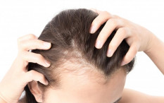 Jangan Bingung! Ini 7 Cara Mudah Atasi Rambut Rontok