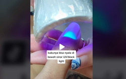 Kuku Penyintas Covid Menyala di Bawah Sinar UV? Begini Penjelasan Dokter
