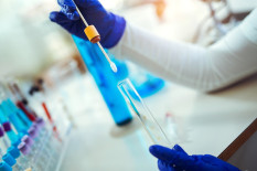 Tes DNA Ternyata Punya Manfaat untuk Kesehatan