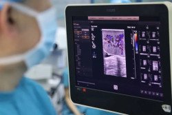 Di China, Peneliti Transplantasi Organ Babi pada Monyet