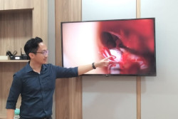 Sering Kedutan, Waspadai Gangguan Saraf yang Bikin Wajah Perot