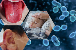 Kenali Gejala dan Penyebab Infeksi Strep A yang Picu Puluhan Kematian di Inggris