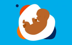 Catat! Ini Makanan yang Harus Dihindari Selama Hamil