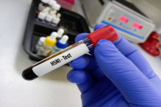 Kenali Jenis Virus Flu Burung yang Berbahaya Bagi Manusia