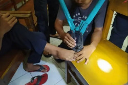Aneh-Aneh, Remaja Iseng Menggembok Jempol Kaki Malah Tak Bisa Dibuka Minta Tolong Damkar