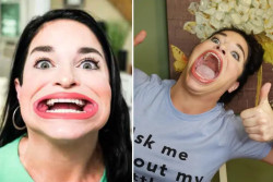 Perempuan dengan Mulut Terbesar di Dunia Abaikan Ejekan dan Pilih Hasilkan Uang Lewat TikTok