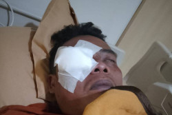Pelaku Pengeroyokan di Gamping Belum Diproses, Pengacara Korban: Ada Kesan Ditutupi