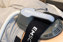 Teknologi Emsculpt Neo Mampu Mengurangi Lemak Tubuh dengan Cepat