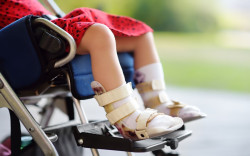 Penyebab dan Gejala Cerebral Palsy, Harus Diketahui Orang Tua