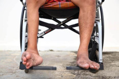 Tak Ada Temuan Polio di Kulonprogo, Dinkes Rutin Lakukan Pemantauan