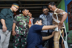 Tiga Kali Diamputasi, Sigit Peroleh Bantuan Kaki Palsu dari Pemkot Jogja