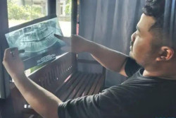 Viral Wanita di Ngawi Meninggal Usai Cabut Gigi Bungsu, Suami Tuntut Dokter Tanggung Jawab
