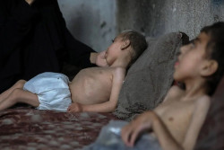 188 Warga di Jalur Gaja Meninggal karena Kelaparan, Termasuk 94 Anak-anak