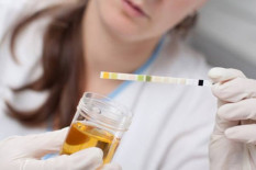 Lapas Semarang Tes Urine 833 WBP Kasus Narkoba