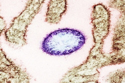 Virus Nipah Belum Masuk DIY, Dinkes Imbau Warga Jaga PHBS