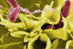 Waspada Salmonella, 34 Kasus Ditemukan di AS