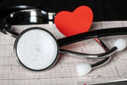Perimenopause Picu Risiko Jantung, Perempuan Wajib Waspada