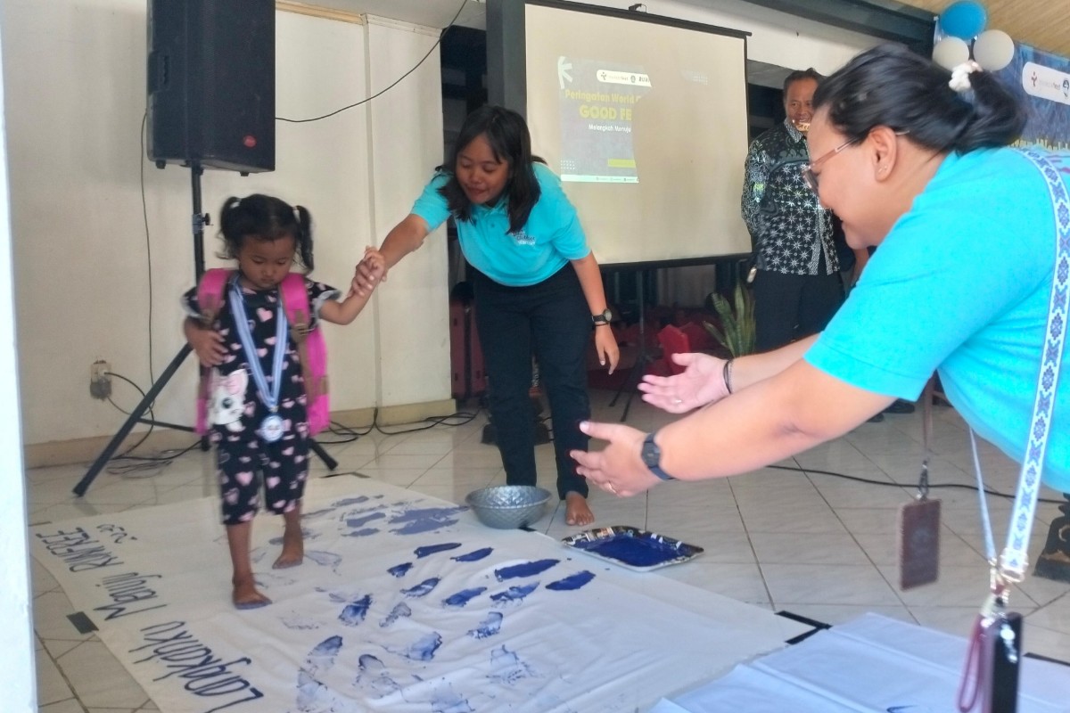 DIY Perkuat Layanan Clubfoot, Pendampingan hingga Jaminan Kesehatan