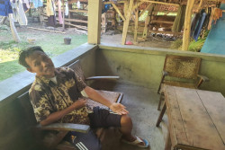 Dua Warga Playen Terluka, Diserang Beruk Lepas dari Penangkaran