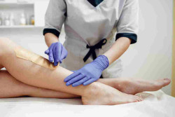 Sebelum Hapus Bulu Tubuh Ketahui Beda Laser dan Waxing