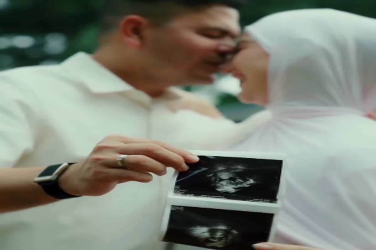 Irish Bella Umumkan Kehamilan, Sebut Buah Hati sebagai Keajaiban