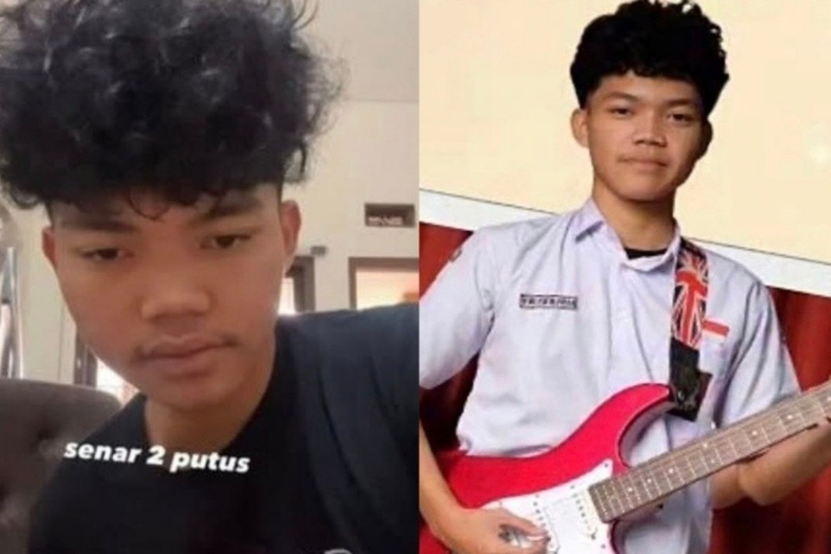 Viral Perundungan Mahasiswa Telkom, Pelaku Semprotkan Cairan dan Api ke Wajah Korban
