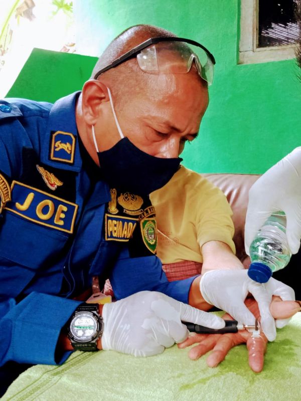 Yohanes Widiyanto saat melepas cincin yang terjebak di jari seorang warga./Istimewa-Dok. Pribadi